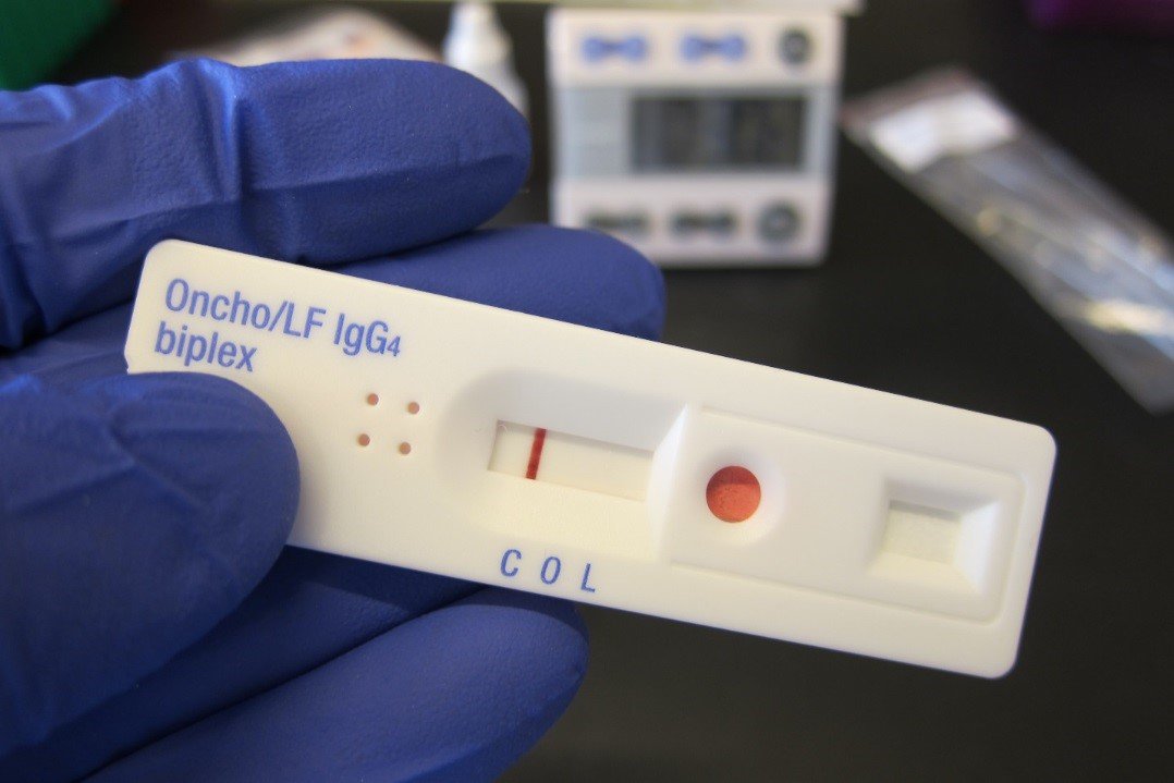 SD BIOLINE Onchocerciasis and Lymphatic Filariasis IgG4 biplex rapid test.