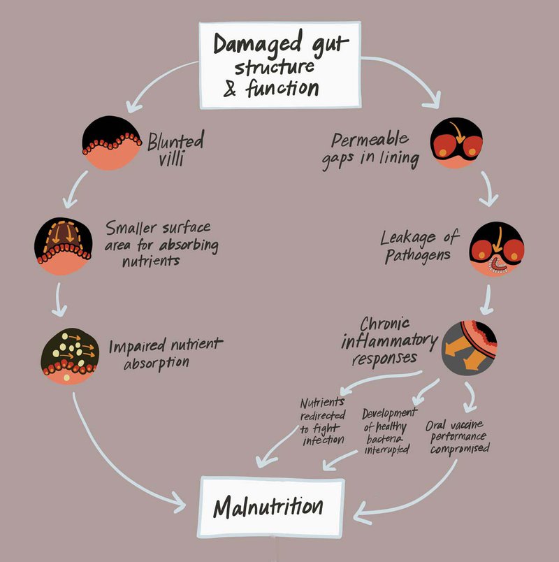 Good gut health is key to optimal growth and development. Without it, children can develop environmental enteric dysfunction, which can result in chronic malnutrition and stunting. Image: PATH.