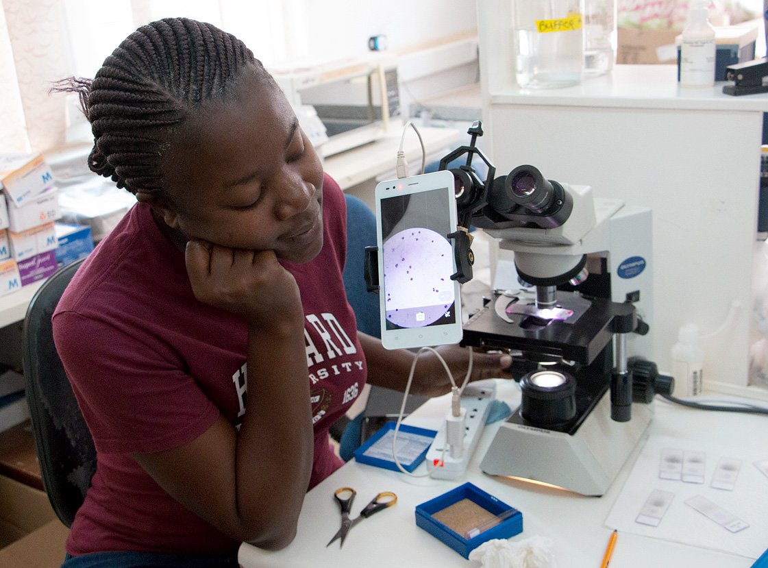 Mulenga, who analyzes blood samples from across Zambia, displays a malaria blood slide on the microscope. The purple dots are white blood cells. PATH: Hunter Lengel Isgrig