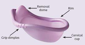 Features of the SILCS diaphragm.