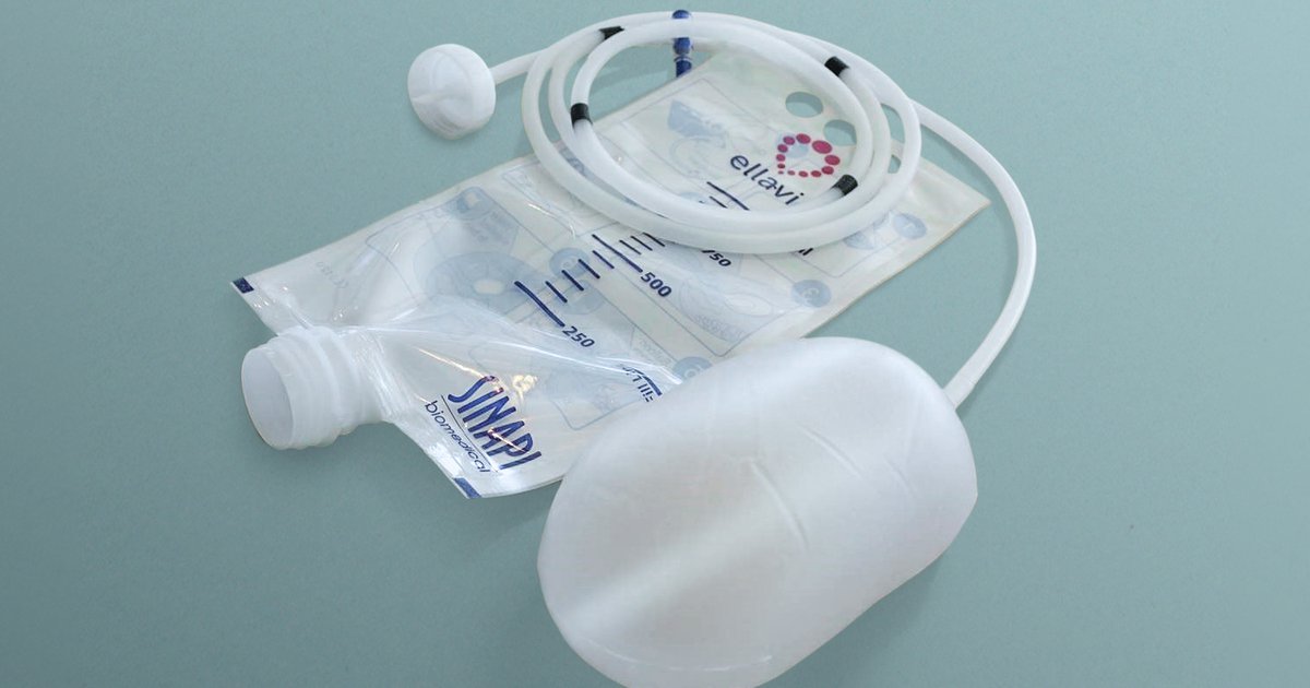 PATH and Sinapi Biomedical launch lifesaving medical device to combat ...