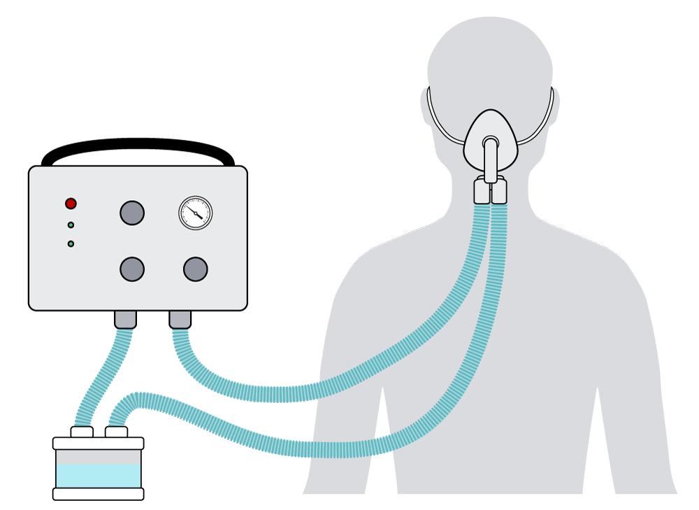 ventilator-open-source-w-humidifier.png